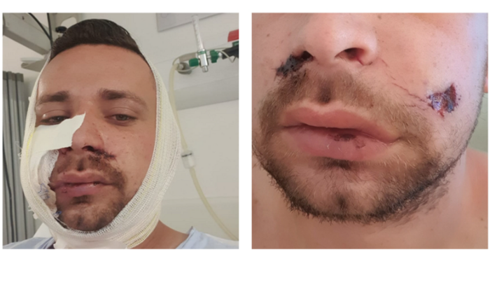 SOS - CIRURGIA DO CARLOS