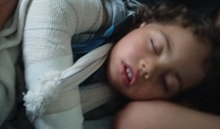 Tyler fraturou a braço, vai ter que operar, estamos indo pra cachoeiro c a roupa do corpo. Se puderem ajudar fortalecerá