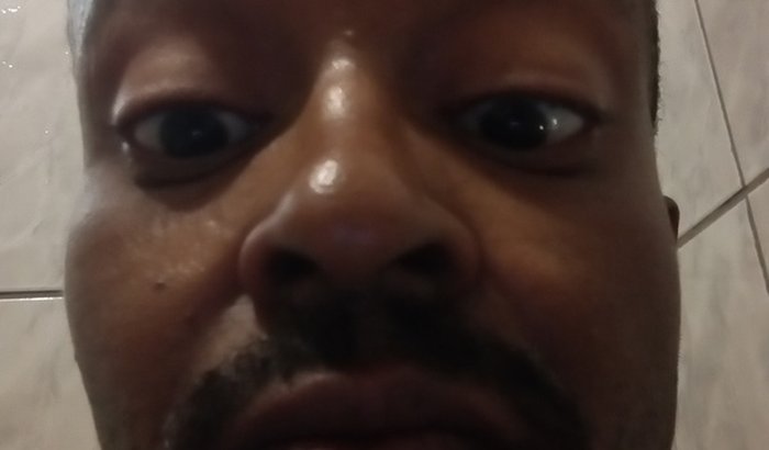 Compra de lentes de contato para tratamento da visão