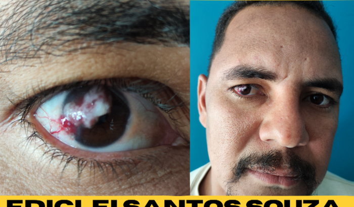 Tratamento de câncer