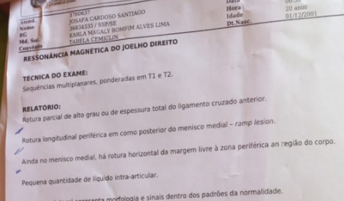 Cirurgia do joelho direito,  rotura do ligamento cruzado 