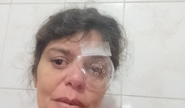 AJUDA PELO MEU TRATAMENTO DE GLÁUCOMA 
