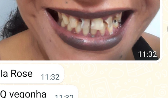 Ajudar uma amiga a realizar o sonho dela de usar uma prótese e ela não tem condições. 