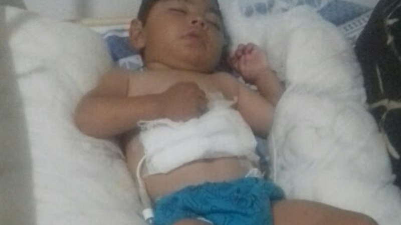 Daniel precisa de uma sonda botton com balonete frente 12 