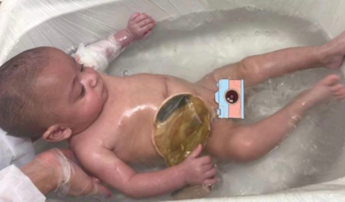 Ajude o Theo