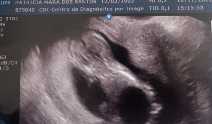 AJUDE NOSSO BEBÊ MILAGRE (mega bexiga)