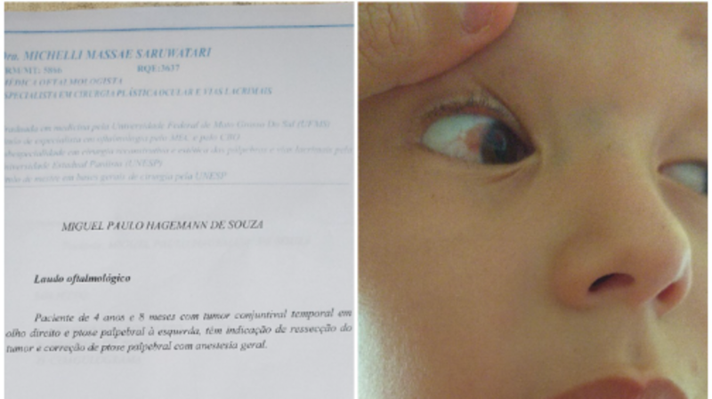 imagem da vaquinha Cirurgia dos olhos 