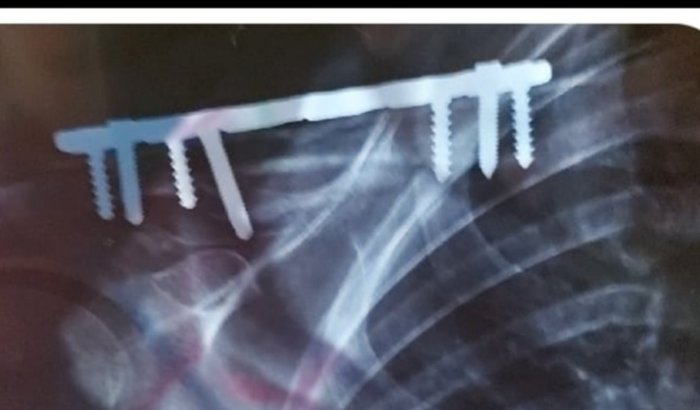 Ajuda para fisioterapia da minha mãe!