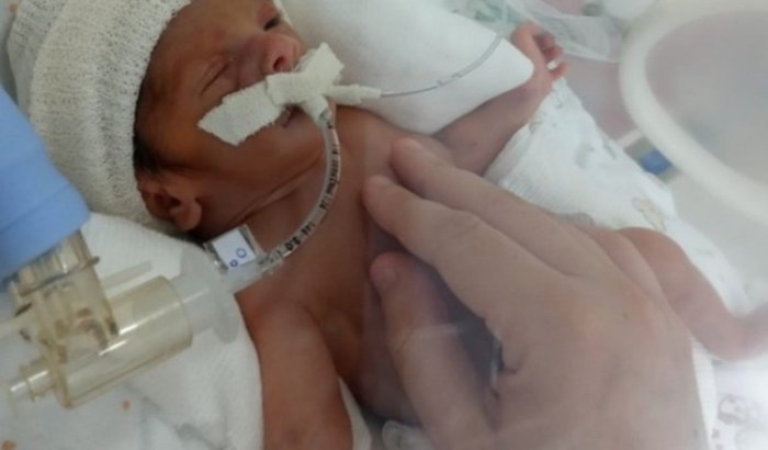 Gente essa e minha neta nasceu prematura e precisa fazer uma cirurgia para n fica com seguelas por favor nos ajude