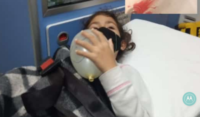 Bianca com politraumatizado craniano precisa de exames complexos Urgente