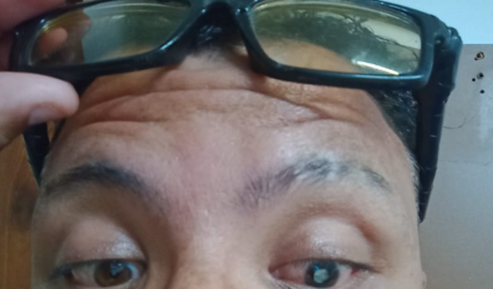 meu óculos de gral peço ajuda só enxergo com a esquerda sem ele to muita do de cabeça