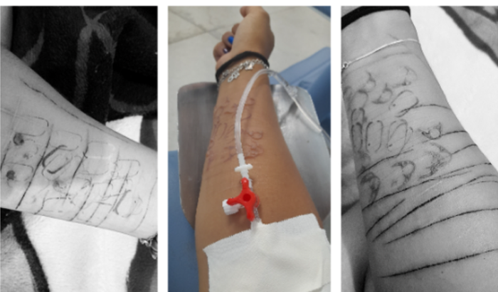 Ajudar com a depressão 