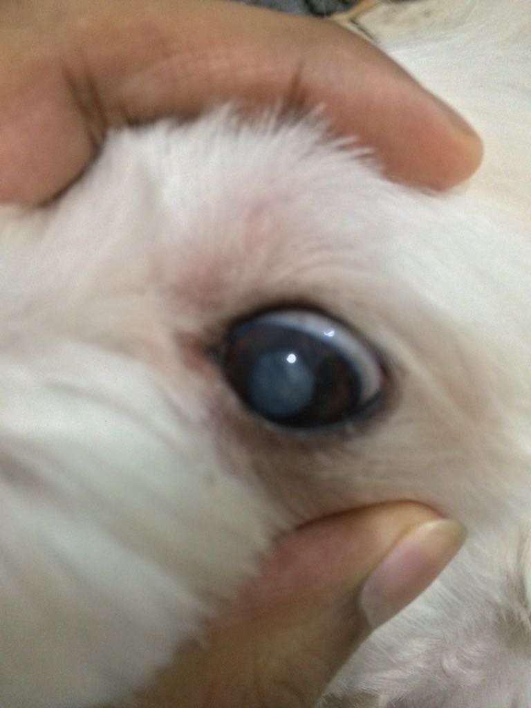 Cirurgia de vista cataratá