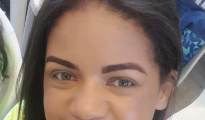 Ajuda para cirurgia oftalmológica nos 2 olhos.