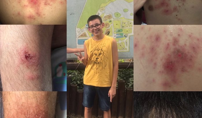 Luta contra Artrite Reumatoide Juvenil