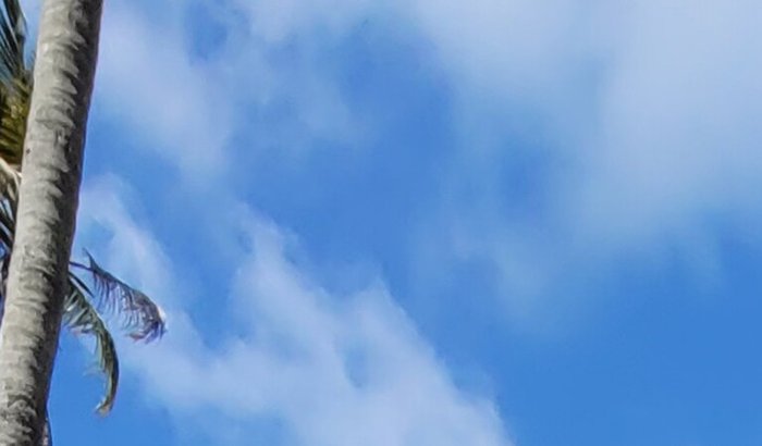 Ajuda pra fazer um transplante capilar