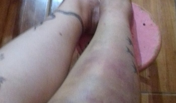 Ajuda para custos do mês com o meu joelho quebrado até Março ir para o INSS
