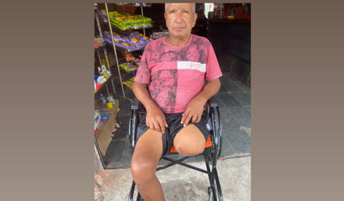 Ajuda para comprar próteses da perna 
