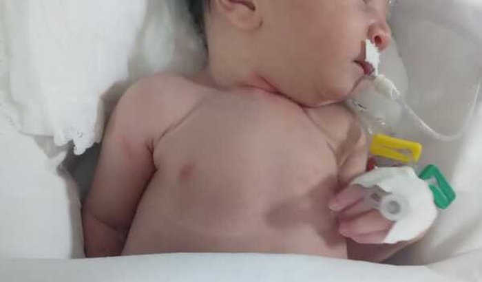Pela saúde do Ravi o bebê de três milagres