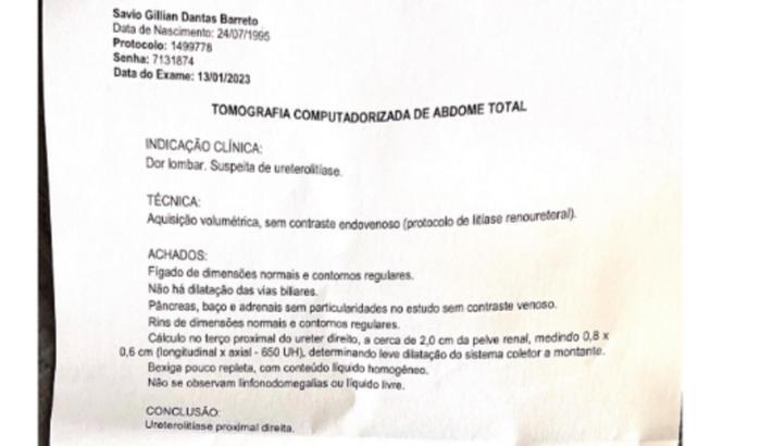 cirurgia de retirada de cálculos renais