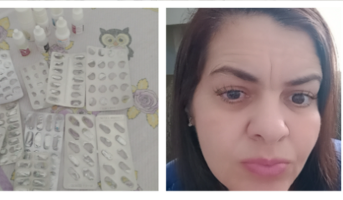 Continuação tratamento olho esquerdo após rejeição de transplante de córnea 