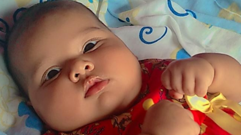 Ajuda a pagar a cirurgia da minha filha