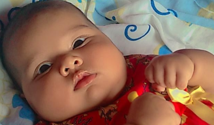 Ajuda a pagar a cirurgia da minha filha