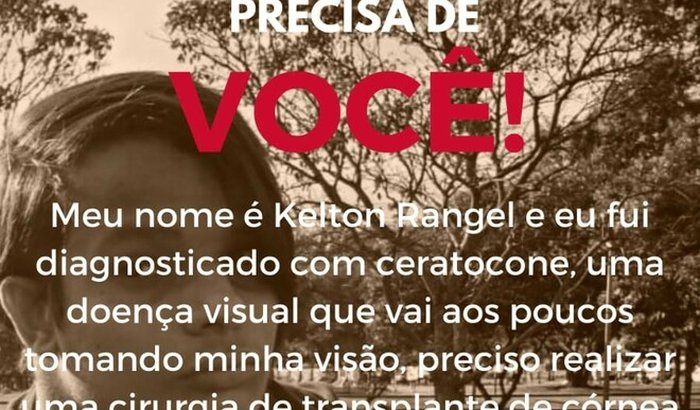 Cirurgia de Córnea do Kelton