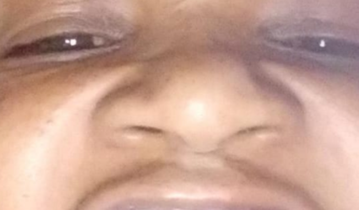 Ajuda para que eu volte a sorrir de novo. Estou sem dente 😭