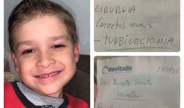 Cirurgia do Davi