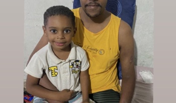 Ajuda para as próteses do Richard 🦿🦿