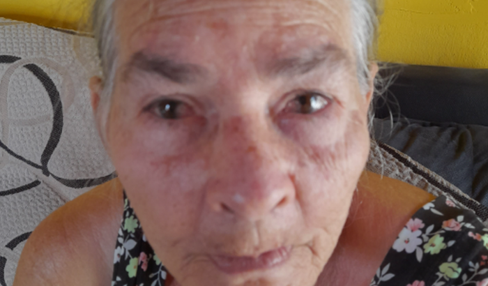 Ajudar na cirurgia da Jandira  da silva