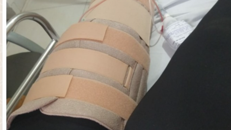 Para ajudar minha neta q sofreu um acidente 