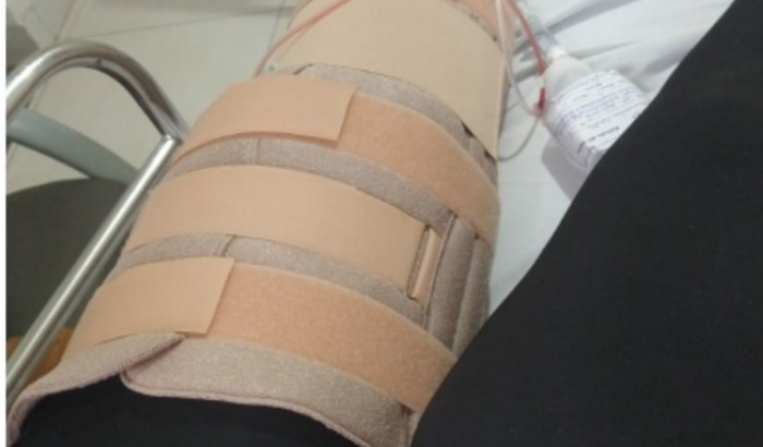 Para ajudar minha neta q sofreu um acidente 