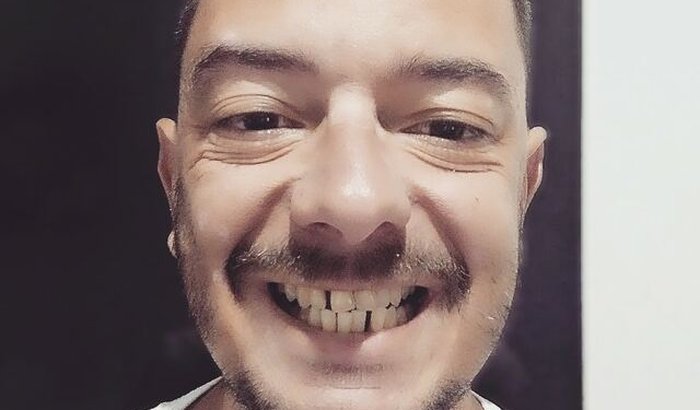 Ajuda para tratamento com meus dentes 