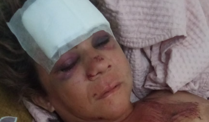 ajudar minha irmã ela está com a coluna fraturada e traumatismo craniano a camada usando fralda tem 37 anos 5 filhos 