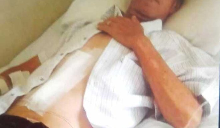 CELIO PRECISA DE SUA AJUDA PARA CONTINUAR VIVO. POS UMA CIRURGIA DE. CANCER NO ESTOMAGO EM ACOMPANHAMENTO.