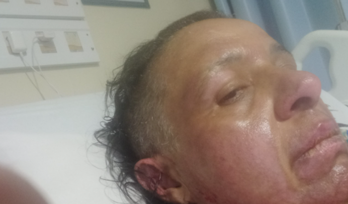 Sofri feminicidio tive o corpo queimado fiquei internada 