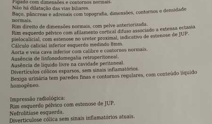 Cirurgia dos rins que parou tá cheio de água tá 20 cm ou mas agora virou cisto e três mioma no útero