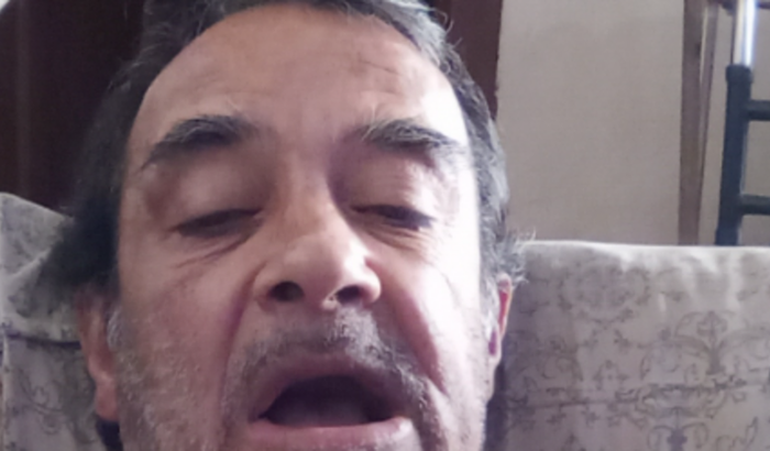 Colocar uma dentadura fixa 