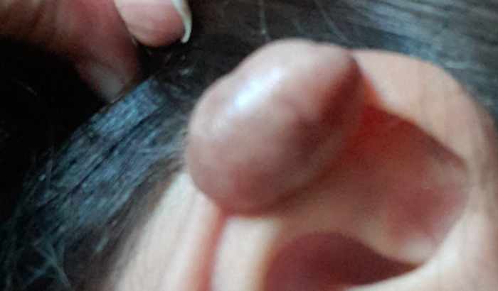 Preciso de ajuda para um tratamento betaterapia custa 3 mil reais me ajudem por favor