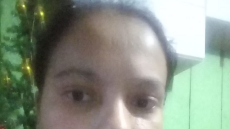 Cirurgia retirada de rir . urgente 