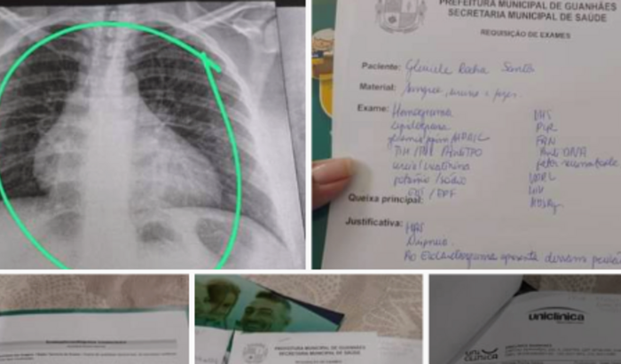Ajuda para exame cardíaco 