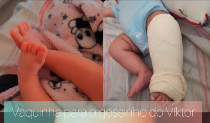 Gesso do Vitinho