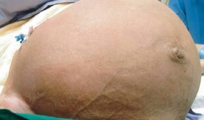 Cirurgia urgente .