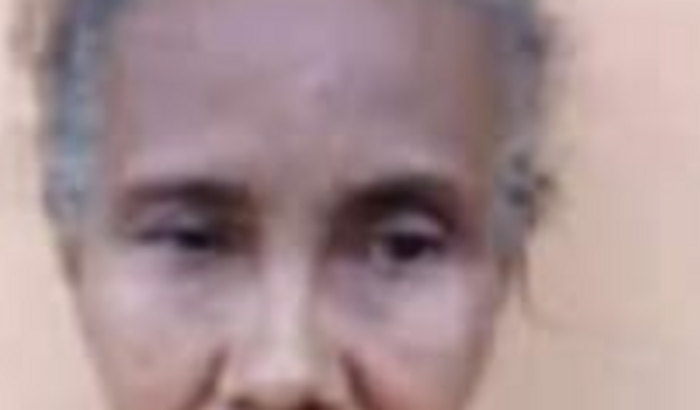 Cirurgia uma massa no celebro com uma modulação tensa de perda das duas vistas.