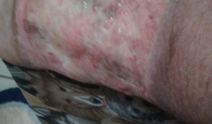 Doações para a cirurgia