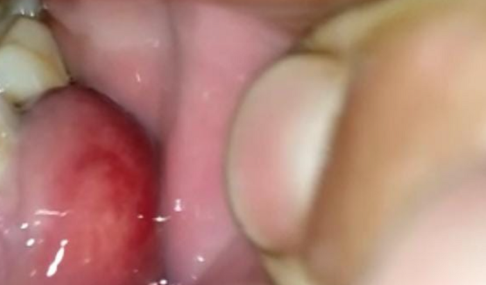Ajuda para tratamento dentário