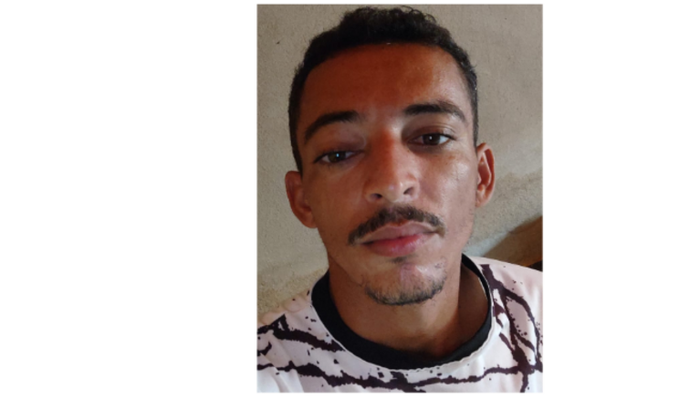 Tumor na parte óssea do olho: Ajudar meu cunhado