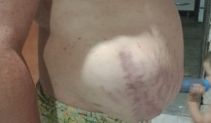 Ajudar o André a Pagar o MEI 
